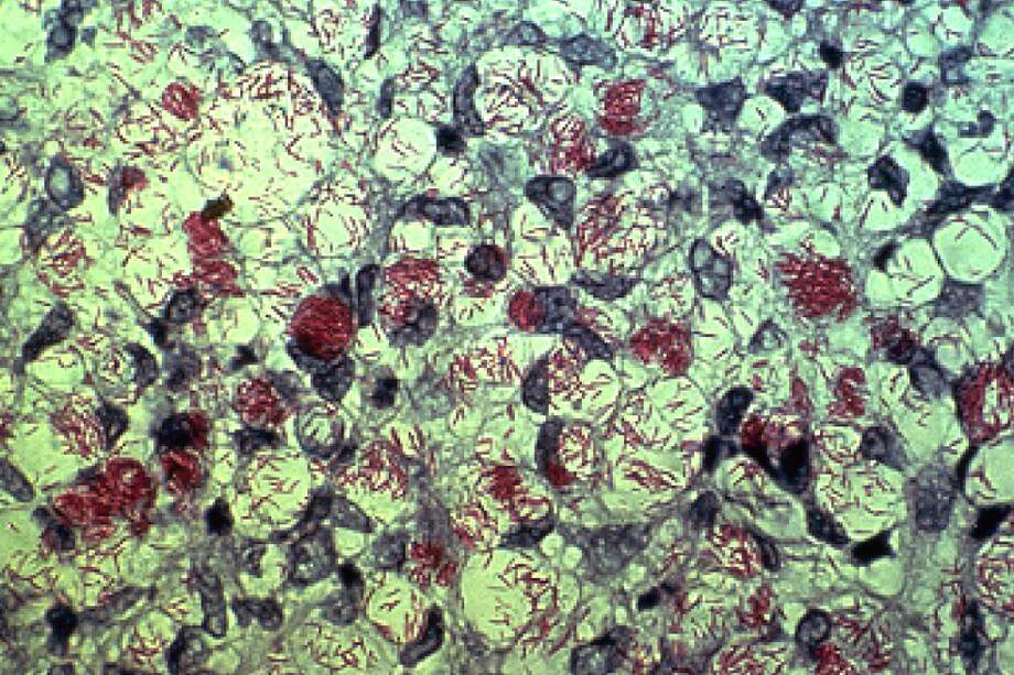 Detalle microscópico de la Mycobacterium leprae, causante de la lepra.  / Wikimedia - Creative Commons - US Department of Health and Human Services